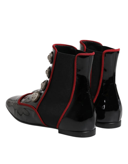 Black Jackie Buttoned Chelsea Boots Shoes